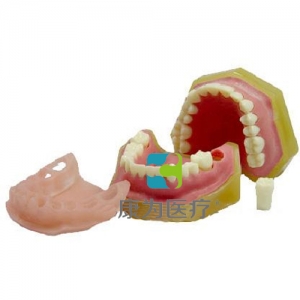 “康為醫療”標準牙頜模型C