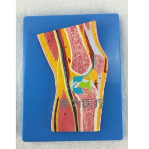 “康為醫療“膝關節剖面模型