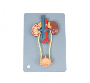 泌尿系統模型Ⅱ型